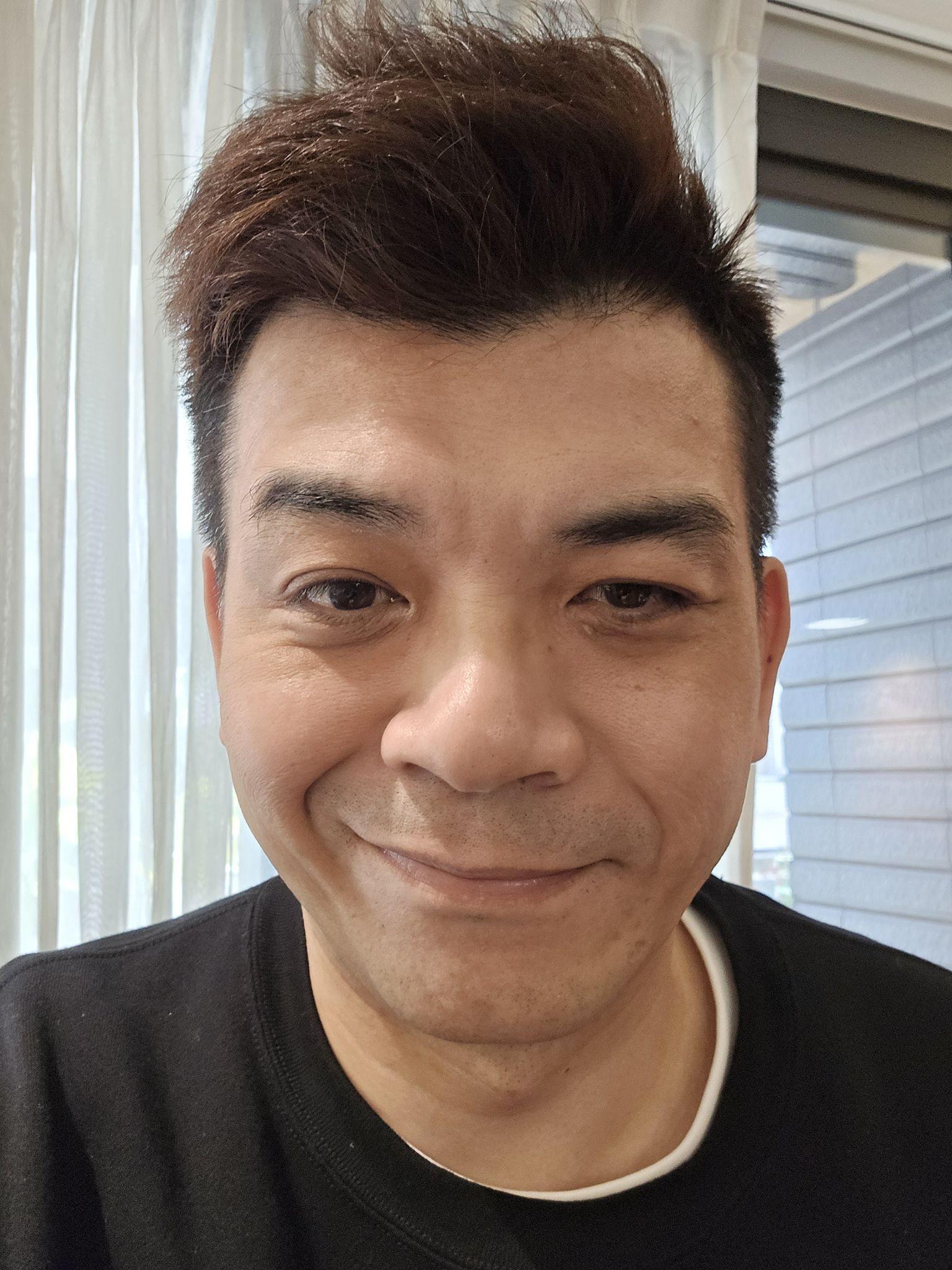 正是好發季節！藝人史丹利嘴歪眼斜　醫推測是「貝爾氏麻痺」