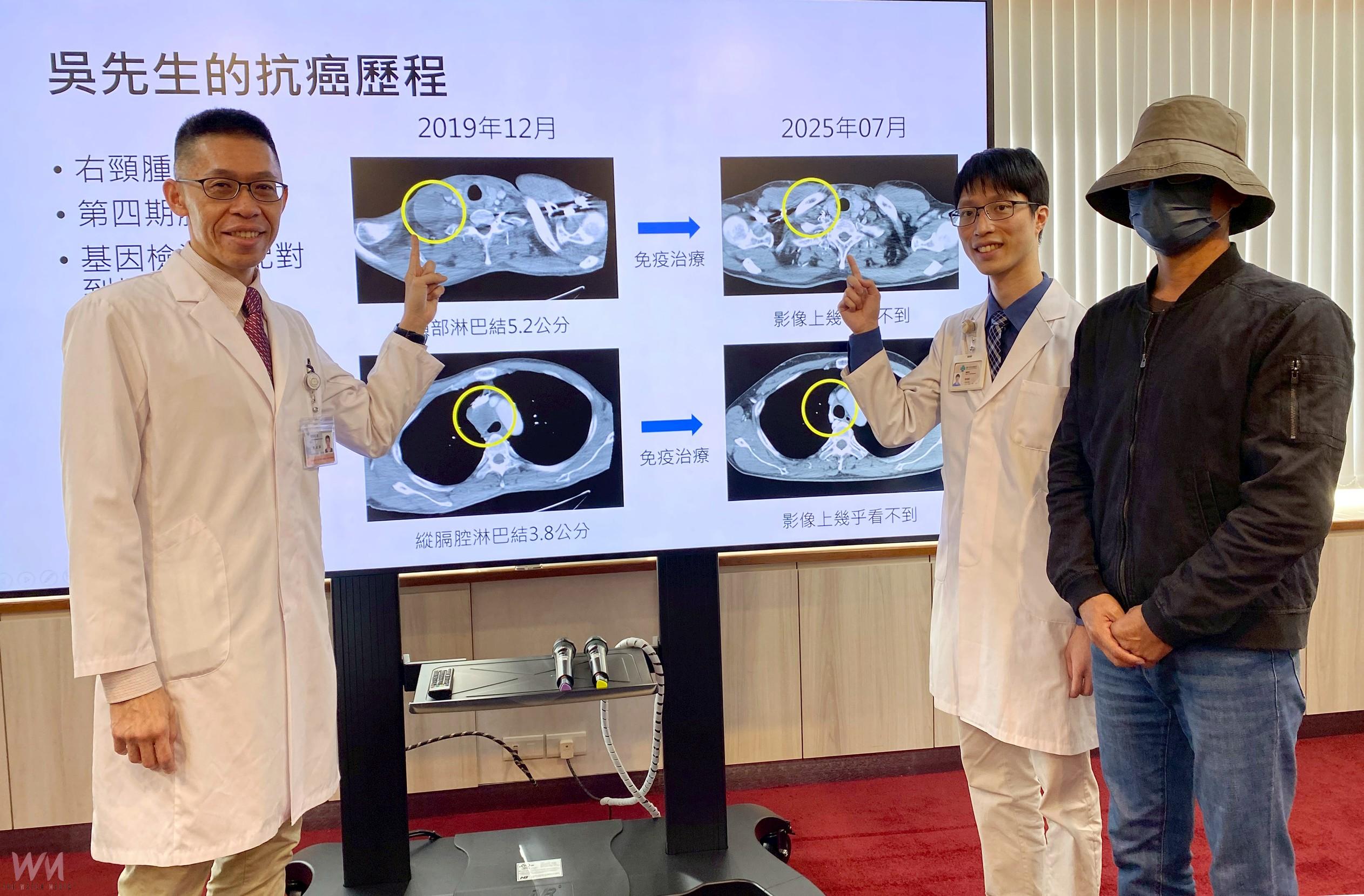精準醫療改寫肺癌命運　四期病人存活逾...